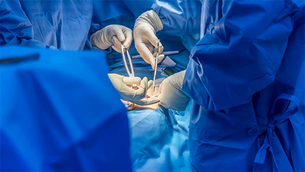 Doctors performing hernia surgery