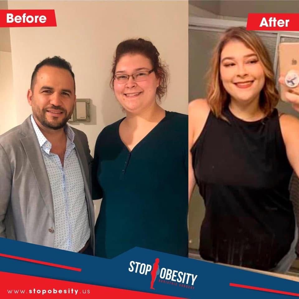 Happy, slim teenager after bariatric surgery