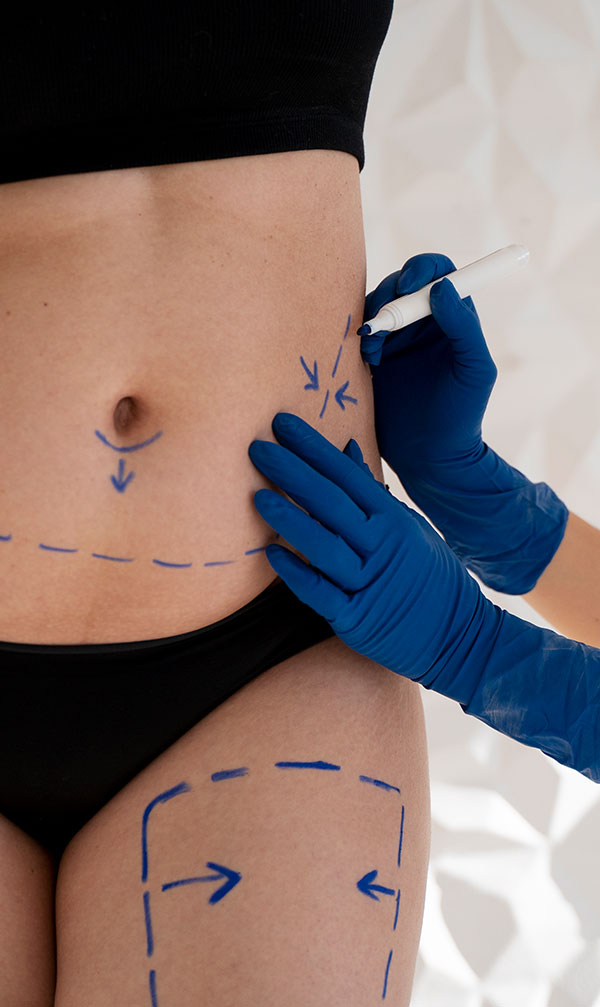 Woman holding hand over stomach after substantial weight loss