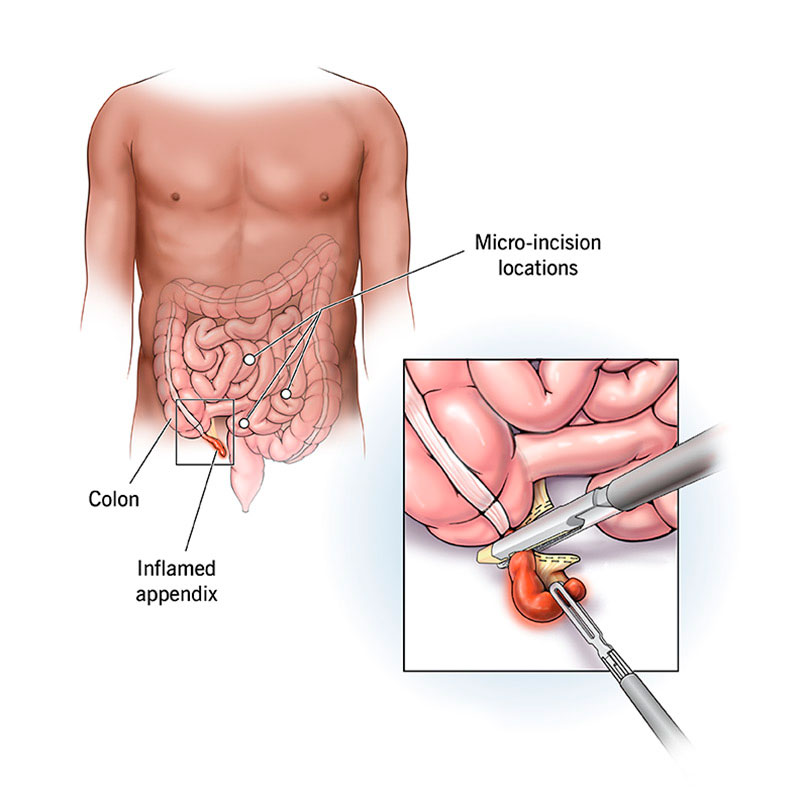 Woman clutching painful stomach