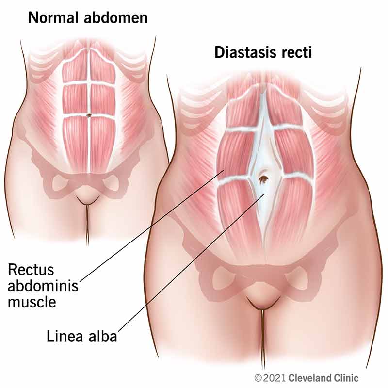 Gastric bypass before and after diagram
